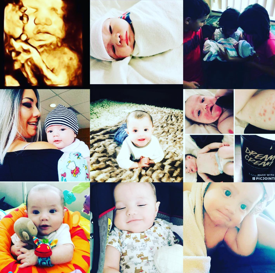 A collage of Lucian as a baby — ultrasound, newborn, with his mom, and showing severe eczema and allergic skin reactions on his back and body